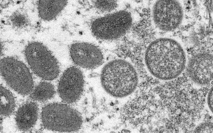 Monkeypox virus entry in PH possible via carrier travelers